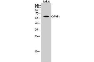 Western Blotting (WB) image for anti-Cytochrome P450, Family 1, Subfamily B, Polypeptide 1 (CYP1B1) (Internal Region) antibody (ABIN3184162) (CYP1B1 Antikörper  (Internal Region))