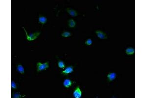 Immunofluorescent analysis of U251 cells using ABIN7168953 at dilution of 1:100 and Alexa Fluor 488-congugated AffiniPure Goat Anti-Rabbit IgG(H+L)