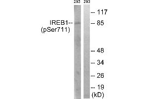 Immunohistochemistry analysis of paraffin-embedded human thyroid gland tissue using IREB1 (Phospho-Ser711) antibody. (Aconitase 1 Antikörper  (pSer711))