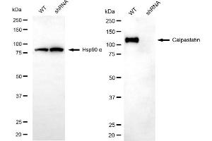 Western blotting analysis using calpastatin antibody (ABIN7797850). (Calpastatin Antikörper)