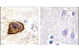 Immunohistochemistry analysis of paraffin-embedded human brain, using PDGFR beta (Phospho-Tyr1021) Antibody. (PDGFRB Antikörper  (pTyr1021))