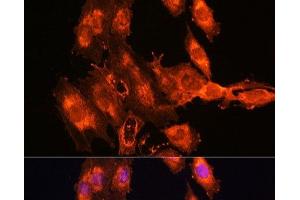 Immunofluorescence analysis of C6 cells using FSTL1 Polyclonal Antibody at dilution of 1:100. (FSTL1 Antikörper)