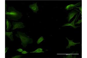 Immunofluorescence of monoclonal antibody to CYP1A2 on HeLa cell. (CYP1A2 Antikörper  (AA 211-310))