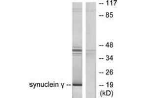 Western blot analysis of extracts from HT29 cells, using Synuclein gamma Antibody.