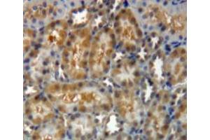 Used in DAB staining on fromalin fixed paraffin-embedded kidney tissue (Gelsolin Antikörper  (AA 432-780))