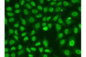 Immunofluorescence analysis of A549 cells using CHEK2 antibody. (CHEK2 Antikörper  (AA 1-220))