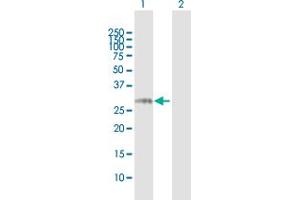 Western Blot analysis of NCR3 expression in transfected 293T cell line by NCR3 MaxPab polyclonal antibody. (NCR3 Antikörper  (AA 1-201))