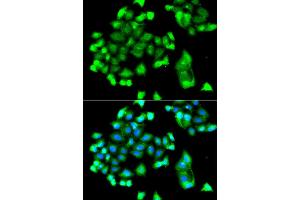 Immunofluorescence analysis of A549 cell using FBXO7 antibody.