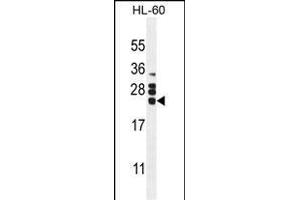 CSF2 Antibody (Center) (ABIN654647 and ABIN2844343) western blot analysis in HL60 cell line lysates (35 μg/lane).