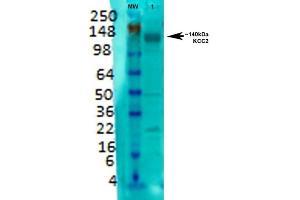 Western Blot analysis of Rat brain membrane lysate showing detection of KCC2 protein using Mouse Anti-KCC2 Monoclonal Antibody, Clone S1-12 (ABIN1027708). (KCC2 Antikörper  (AA 932-1043))
