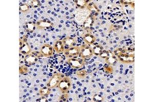 Immunohistochemistry analysis of paraffin-embedded mouse kidney using,PKD2L1 (ABIN7075125) at dilution of 1: 3400