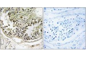 Immunohistochemistry (IHC) image for anti-Dynein, Light Chain, Roadblock Type 2 (DYNLRB2) (AA 21-70) antibody (ABIN1534857)