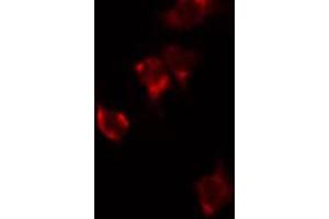 ABIN6272351 staining HuvEc by IF/ICC. (MRPL48 Antikörper  (Internal Region))