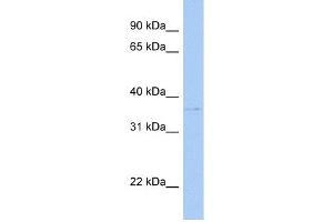 WB Suggested Anti-SULT1C2 Antibody Titration:  0. (SULT1C2 Antikörper  (C-Term))