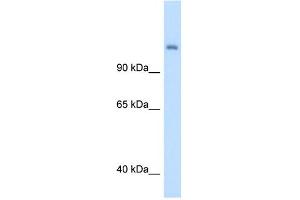 CPS1 antibody used at 5 ug/ml to detect target protein.