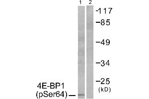 Western blot analysis of extracts from Jurkat cells, treated with Insulin (0. (eIF4EBP1 Antikörper  (pSer64))