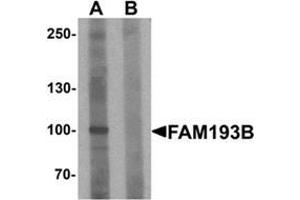 Western blot analysis of FAM193B in Jurkat cell lysate with FAM193B Antibody  at 1 ug/ml in (A) the absence and (B) the presence of blocking peptide. (FAM193B Antikörper  (N-Term))