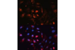 Immunofluorescence analysis of U2OS cells using  antibody (ABIN6133586, ABIN6137050, ABIN6137052 and ABIN6225252) at dilution of 1:100. (Aquaporin 5 Antikörper  (AA 150-250))