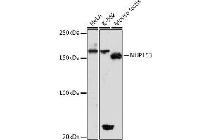 Western blot analysis of extracts of various cell lines, using NUP153 Rabbit mAb (ABIN1512527, ABIN3023298, ABIN3023299 and ABIN7101477) at 1:1000 dilution.