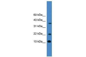 CASP4 antibody used at 0. (Caspase 4 Antikörper  (Middle Region))