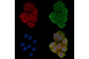 ABIN6256850 and ABIN6273556 staining Hela cells(45 min of heat-shock treatment) by IF/ICC. (ERC1 Antikörper  (N-Term))