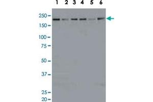 Identification of KDM5A in crude cell extracts by western blotting with KDM5A monoclonal antibody, clone 18E8 .