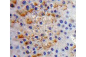 IHC-P analysis of liver tissue, with DAB staining. (IL17RC Antikörper  (AA 257-477))