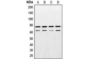 Western blot analysis of Lamin A/C expression in A431 (A), HeLa (B), NIH3T3 (C), PC12 (D) whole cell lysates. (Lamin A/C Antikörper  (Center))
