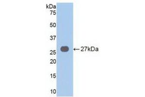 Detection of Recombinant VAV3, Human using Polyclonal Antibody to Vav 3 Oncogene (VAV3) (VAV3 Antikörper  (AA 183-380))