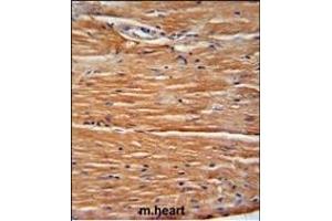 Immunohistochemistry (Paraffin-embedded Sections) (IHC (p)) image for anti-GIT1 (GIT1) (AA 485-512) antibody (ABIN6243000)