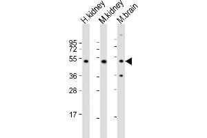 All lanes : Anti-NDUFV1 Antibody (N-term) at 1:2000 dilution Lane 1: human kidney lysate Lane 2: mouse kidney lysate Lane 3: mouse brain lysate Lysates/proteins at 20 μg per lane. (NDUFV1 Antikörper  (N-Term))