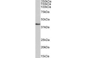 ABIN4902659 (0. (HMBS Antikörper)