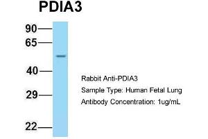 Host: Rabbit  Target Name: PDIA3  Sample Tissue: Human Fetal Lung  Antibody Dilution: 1. (PDIA3 Antikörper  (C-Term))