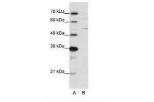 Image no. 2 for anti-Heterogeneous Nuclear Ribonucleoprotein K (HNRNPK) (N-Term) antibody (ABIN6736200) (HNRNPK Antikörper  (N-Term))