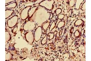 Immunohistochemistry of paraffin-embedded human thyroid tissue using ABIN7174723 at dilution of 1:100 (C12orf43 Antikörper  (AA 1-263))