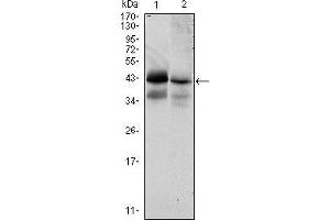 Western blot analysis using EPCAM mouse mAb against HTC116 (1) and T47D (2) cell lysate. (EpCAM Antikörper)