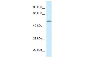 Western Blot showing GCK antibody used at a concentration of 1 ug/ml against COLO205 Cell Lysate (GCK Antikörper  (N-Term))
