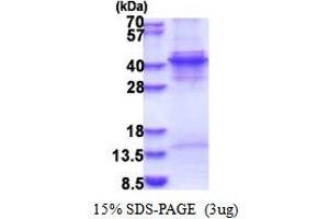 SDS-PAGE (SDS) image for Kruppel-Like Factor 6 (KLF6) (AA 1-283) protein (His tag) (ABIN5853533) (KLF6 Protein (AA 1-283) (His tag))