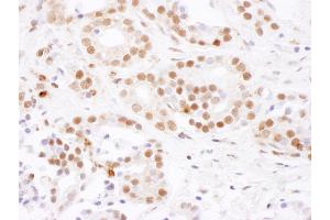 anti-Splicing Factor 3b, Subunit 4, 49kDa (SF3B4) (AA 374-424) antibody