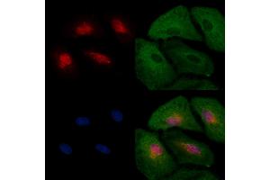 ABIN6263548 and ABIN6277572 staining  cells by IF/ICC. (NDC80 Antikörper  (C-Term))