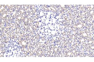 Detection of CNR1 in Rat Kidney Tissue using Polyclonal Antibody to Cannabinoid Receptor 1, Brain (CNR1) (CNR1 Antikörper  (AA 1-117))