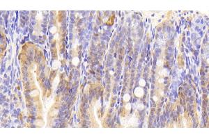 Detection of GAL2 in Mouse Colon Tissue using Polyclonal Antibody to Galectin 2 (GAL2) (Gallinacin-2 (GAL2) (AA 1-130) Antikörper)