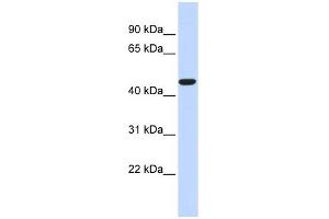 ACOT2 antibody used at 1 ug/ml to detect target protein.