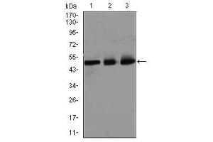 Image no. 5 for anti-E2F Transcription Factor 1 (E2F1) antibody (ABIN1491636) (E2F1 Antikörper)