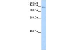 Western Blotting (WB) image for anti-CDKN1A Interacting Zinc Finger Protein 1 (CIZ1) antibody (ABIN2461822) (CIZ1 Antikörper)