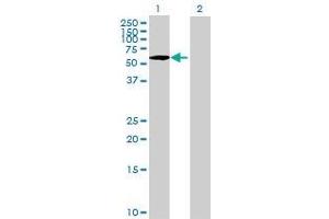 Lane 1: PLK1 transfected lysate ( 66. (PLK1 293T Cell Transient Overexpression Lysate(Denatured))
