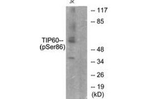 Western blot analysis of extracts from Jurkat cells, using TIP60 (Phospho-Ser86) Antibody. (KAT5 Antikörper  (pSer86))