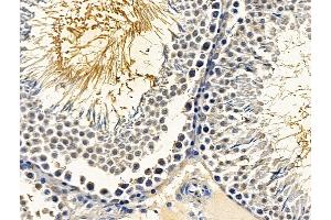 ABIN7096682 and ABIN7100747 at 1/100 staining rat testis tissue by IHC-P. (RCAN3 Antikörper)