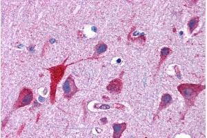Immunohistochemistry (IHC) image for anti-Tumor Protein D52-Like 2 (TPD52L2) (C-Term) antibody (ABIN334516)