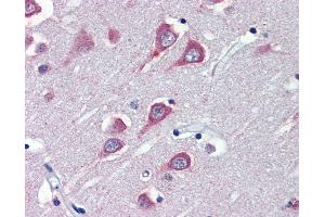 Anti-FAAH antibody IHC of human brain, cortex.